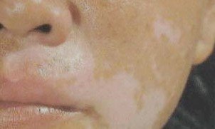 �沿���综��