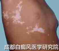 ����Ի�����ɵ�Σ��